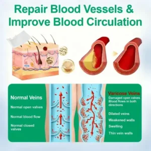 Healrize® VeinEase Microneedle Care PatchInstant Relief, Long-Term Results