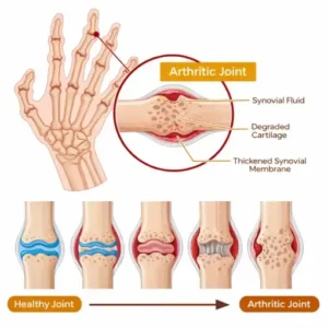 Healrize®Bee Venom Bone Healing Pain-Relief Cream