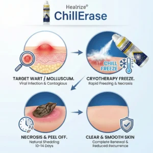 Healrize®ChillErase Gentle Bump Renewal Spray✨ — Pain-Free, Acid-Free Gentle Wart Removal