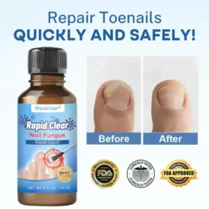 Healrize®Nano Rapid Clear Nail Fungus Rapair Liquid Effective in 7 Days, Permanently Eliminates the Root