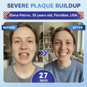 𝐇𝐞𝐚𝐥𝐫𝐢𝐳𝐞® Tideglusib Fast‑Dissolving Tooth & Gum Repair Oral Strips