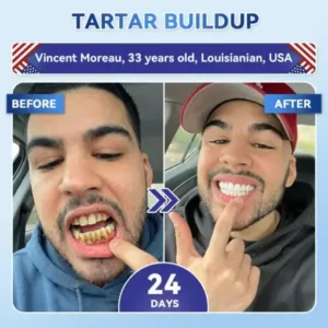𝐇𝐞𝐚𝐥𝐫𝐢𝐳𝐞® Tideglusib Fast‑Dissolving Tooth & Gum Repair Oral Strips