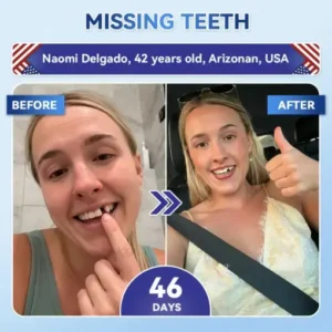 𝐇𝐞𝐚𝐥𝐫𝐢𝐳𝐞® Tideglusib Fast‑Dissolving Tooth & Gum Repair Oral Strips