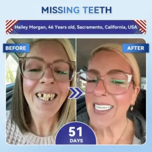 𝐇𝐞𝐚𝐥𝐫𝐢𝐳𝐞® Tideglusib Fast‑Dissolving Tooth & Gum Repair Oral Strips