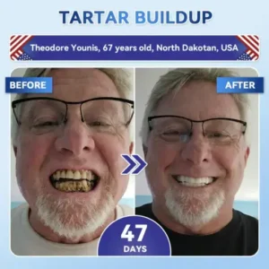 𝐇𝐞𝐚𝐥𝐫𝐢𝐳𝐞® Tideglusib Fast‑Dissolving Tooth & Gum Repair Oral Strips