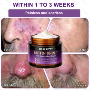✨Best Seller🔥Healrize® Biotin 10-in-1 Skin Restoration Cream 🎉Special limited-time discount