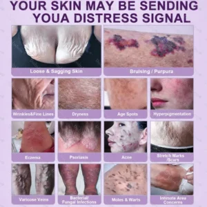 ✨Best Seller🔥Healrize® Biotin 10-in-1 Skin Restoration Cream 🎉Special limited-time discount