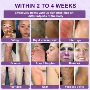 ✨Best Seller🔥Healrize® Biotin 10-in-1 Skin Restoration Cream 🎉Special limited-time discount