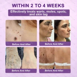 ✨Best Seller🔥Healrize® Biotin 10-in-1 Skin Restoration Cream 🎉Special limited-time discount