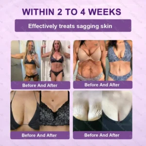 ✨Best Seller🔥Healrize® Biotin 10-in-1 Skin Restoration Cream 🎉Special limited-time discount