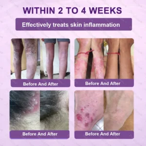 ✨Best Seller🔥Healrize® Biotin 10-in-1 Skin Restoration Cream 🎉Special limited-time discount