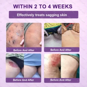 ✨Best Seller🔥Healrize® Biotin 10-in-1 Skin Restoration Cream 🎉Special limited-time discount