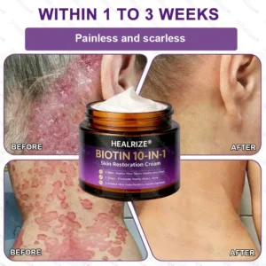 ✨Best Seller🔥Healrize® Biotin 10-in-1 Skin Restoration Cream 🎉Special limited-time discount