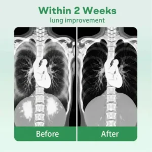 Healrize® 𝐇𝐞𝐫𝐛𝐚𝐥 𝐋𝐮𝐧𝐠 𝐂𝐥𝐞𝐚𝐧𝐬𝐢𝐧𝐠 𝐈𝐧𝐡𝐚𝐢𝐞𝐫