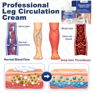 🔥Healrize® Advanced Edema Relief Cream | Herbal Soothing Ointment for Varicose Veins, Swelling & Leg Circulation🌿
