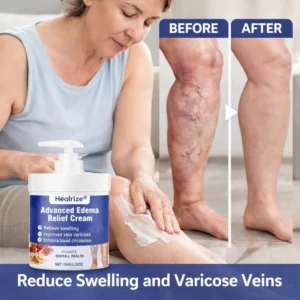 🔥Healrize® Advanced Edema Relief Cream | Herbal Soothing Ointment for Varicose Veins, Swelling & Leg Circulation🌿