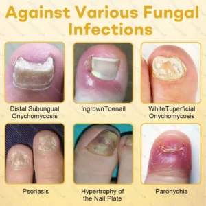 Healrize® Bee Venom Nail Rescue Spray