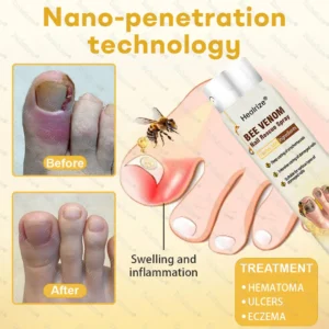 Healrize® Bee Venom Nail Rescue Spray