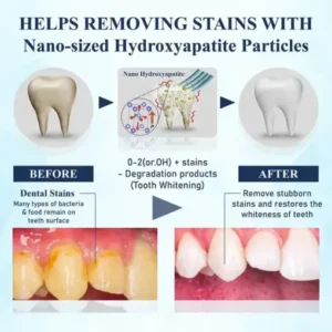 Healrize® BioEnamel Biomimetic Tooth Armor