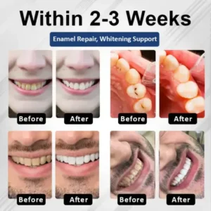 Healrize® BioEnamel Biomimetic Tooth Armor