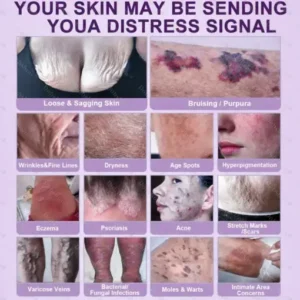 Healrize® Biotin 10-in-1 Skin Restoration Cream