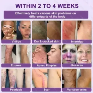 Healrize® Biotin 10-in-1 Skin Restoration Cream