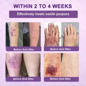 Healrize® Biotin 10-in-1 Skin Restoration Cream