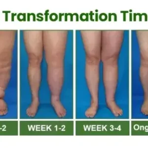 Healrize® Light Legs Swelling & Circulation Relief Spray