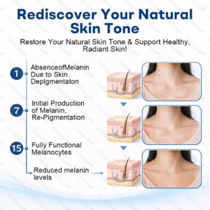 🔥Healrize® Piperine Vitiligo Repigmentation Spray - 👨‍⚕️✅Steroid-Free Botanical Formula | Gentle & Effective for All Skin Types
