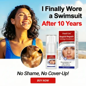 🔥Healrize® Rapid Repair Vitiligo Essence — Visible Results in Weeks, 100% Natural & Steroid-Free