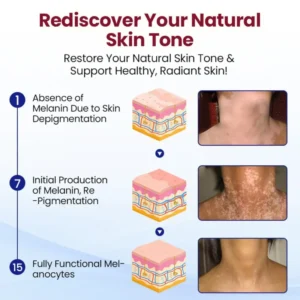 🔥Healrize® Rapid Repair Vitiligo Essence — Visible Results in Weeks, 100% Natural & Steroid-Free