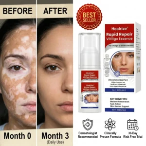 Healrize® Rapid Repair Vitiligo Essence