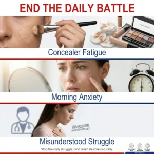 Healrize® Rapid Repair Vitiligo Essence