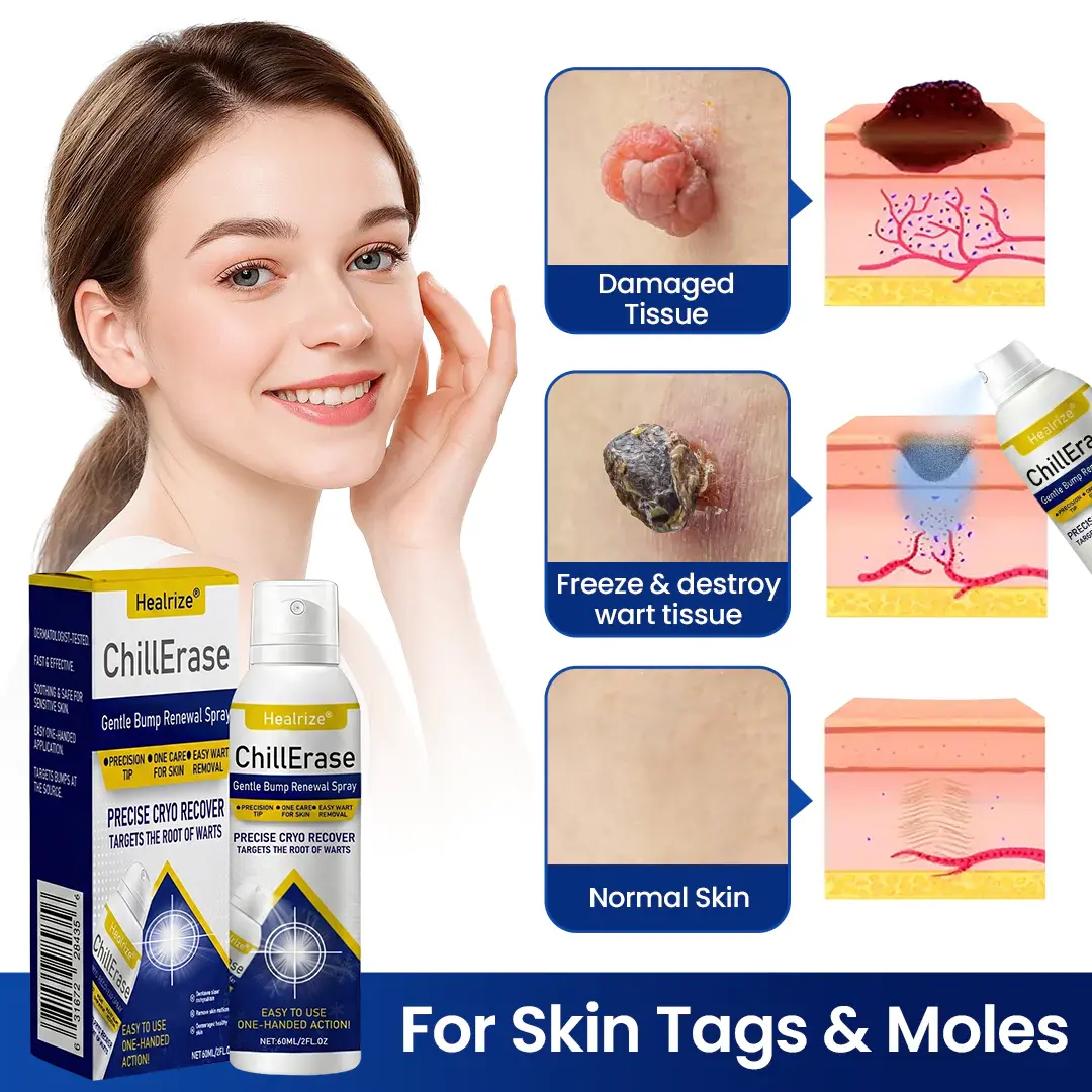 ❄️Healrize®ChillErase Gentle Bump Renewal Spray—Stubborn Skin Bumps & Rough Spots