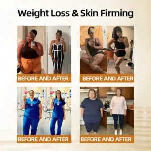 𝑶𝒇𝒇𝒊𝒄𝒊𝒂𝒍 𝑺𝒕𝒐𝒓𝒆  | 👩‍⚕️ H𝐞a𝐥r𝐢z𝐞®Moringa Berberine 10-in-1 Microgranule Body-Shaping Fat-Burning Patch(𝐎𝐧𝐜𝐞 𝐃𝐚𝐢𝐥𝐲, 𝐯𝐢𝐬𝐢𝐛𝐥𝐞 𝐜𝐡𝐚𝐧𝐠𝐞𝐬 𝐢𝐧 𝟕 𝐝𝐚𝐲𝐬） F𝐨r 𝐎𝐛𝐞𝐬𝐢𝐭𝐲, 𝐋o𝐨s𝐞 𝐒k𝐢n, 𝐃𝐢𝐚𝐛𝐞𝐭𝐞𝐬, 𝐒𝐥𝐞𝐞𝐩 𝐀𝐩𝐧𝐞𝐚, 𝐀𝐧𝐝 𝐉𝐨𝐢𝐧𝐭 𝐈𝐬𝐬𝐮𝐞𝐬🎁