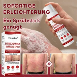 🌟Bestseller |🐌Healrize® Schneckenmucin-Barriere-Spray zur Linderung von Hautschüben und zur Regeneration der Haut-𝘿𝙚𝙪𝙩𝙨𝙘𝙝𝙡𝙖𝙣𝙙𝙨 𝙉𝙧. 1 𝙨𝙥𝙧ü𝙝𝙗𝙖𝙧𝙚 𝘽𝙖𝙧𝙧𝙞𝙚𝙧𝙚-𝙋𝙛𝙡𝙚𝙜𝙚 𝙗𝙚𝙞 𝙋𝙨𝙤𝙧𝙞𝙖𝙨𝙞𝙨