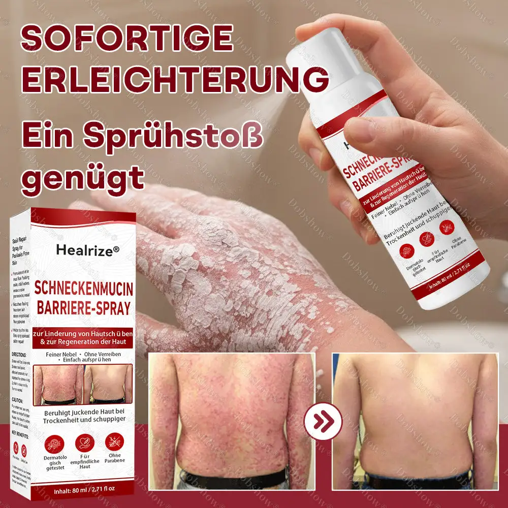 ๐Bestseller |๐Healrizeยฎ Schneckenmucin-Barriere-Spray zur Linderung von Hautschรผben und zur Regeneration der Haut-๐ฟ๐๐ช๐ฉ๐จ๐๐๐ก๐๐ฃ๐๐จ ๐๐ง. 1 ๐จ๐ฅ๐งรผ๐๐๐๐ง๐ ๐ฝ๐๐ง๐ง๐๐๐ง๐-๐๐๐ก๐๐๐ ๐๐๐ ๐๐จ๐ค๐ง๐๐๐จ๐๐จ
