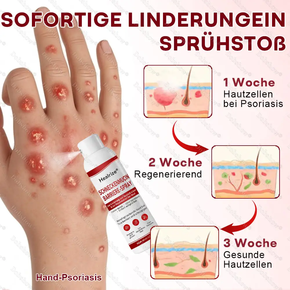 ๐Bestseller |๐Healrizeยฎ Schneckenmucin-Barriere-Spray zur Linderung von Hautschรผben und zur Regeneration der Haut-๐ฟ๐๐ช๐ฉ๐จ๐๐๐ก๐๐ฃ๐๐จ ๐๐ง. 1 ๐จ๐ฅ๐งรผ๐๐๐๐ง๐ ๐ฝ๐๐ง๐ง๐๐๐ง๐-๐๐๐ก๐๐๐ ๐๐๐ ๐๐จ๐ค๐ง๐๐๐จ๐๐จ
