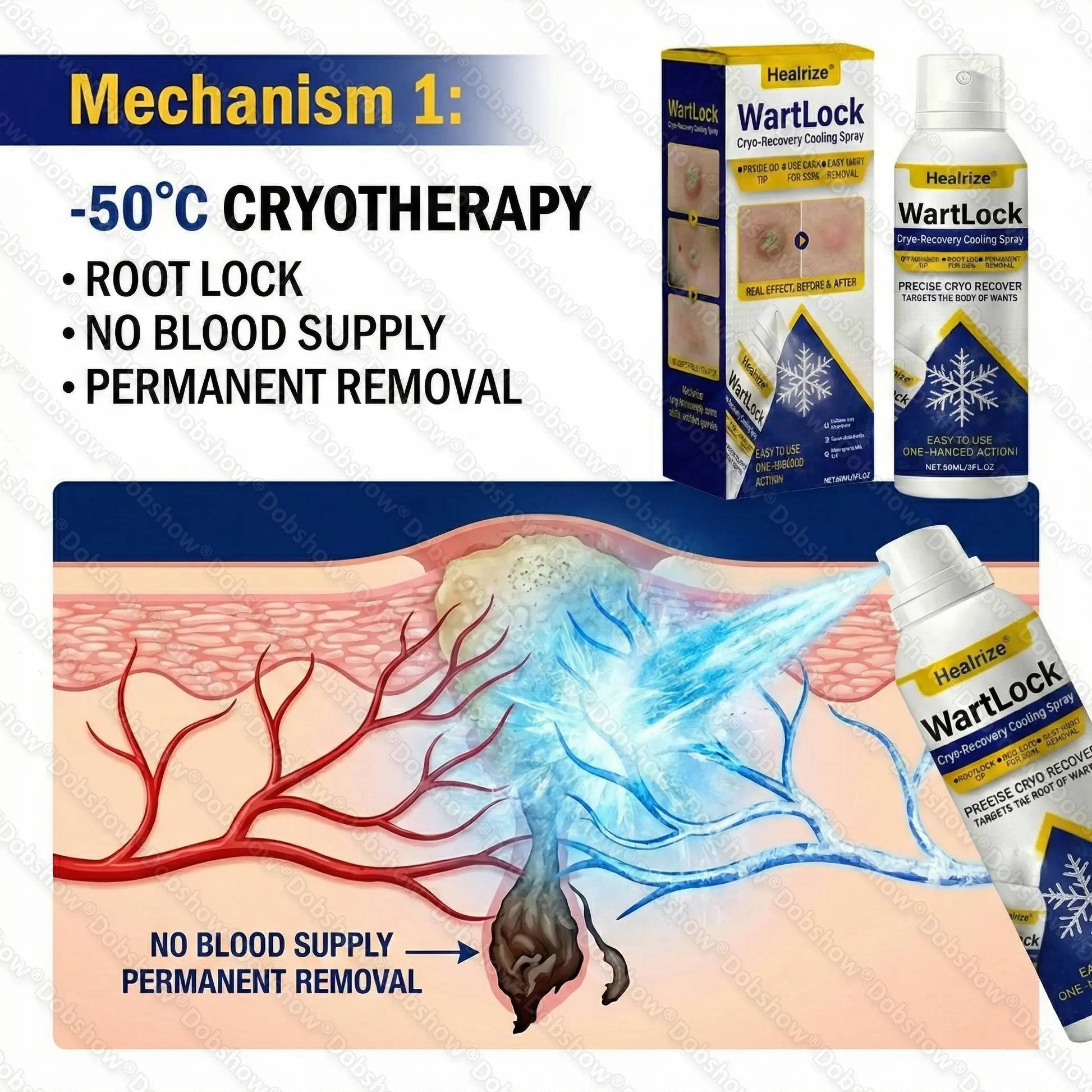 🏆Flash Sale⚡ 50K+ SOLD⏰✨| Healrize® Wart Lock Cryo-Recovery Cooling Spray