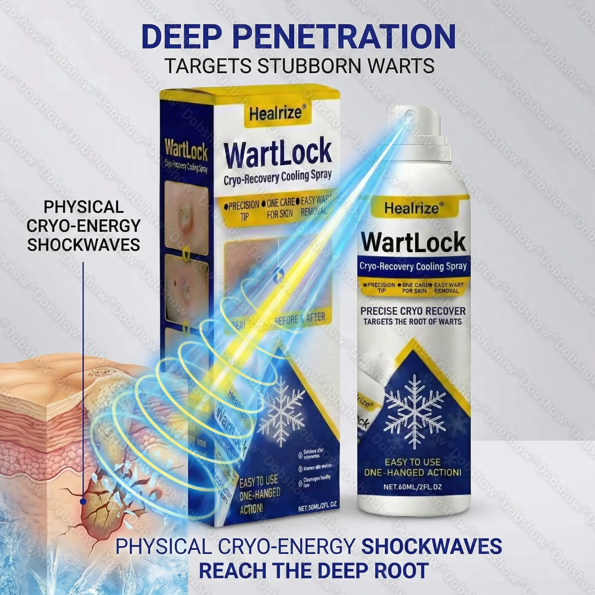 🏆Flash Sale⚡ 50K+ SOLD⏰✨| Healrize® Wart Lock Cryo-Recovery Cooling Spray