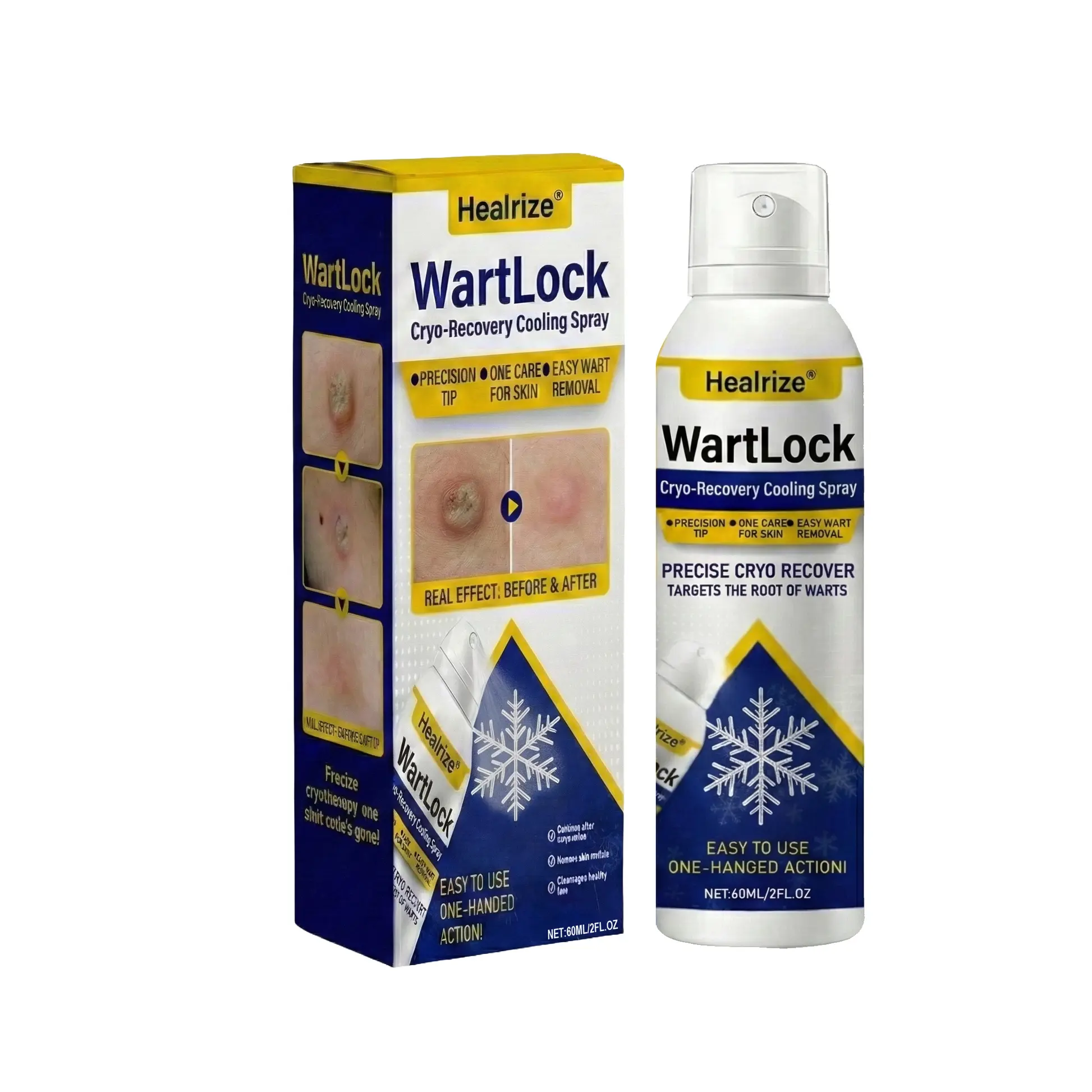 🏆Flash Sale⚡ 50K+ SOLD⏰✨| Healrize® Wart Lock Cryo-Recovery Cooling Spray