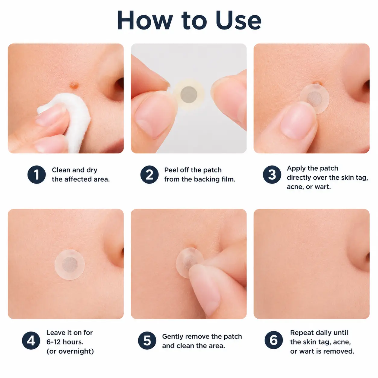 โ
๐บ๐ธ๐๐๐๐๐ฟ๐ถ๐ฏ๐ยฎ2-in-1 Microneedle & Hydrocolloid Patch๐| Removes Raised M
โ Cce Enchanted Store