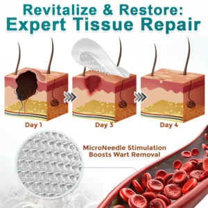 โ
๐บ๐ธ๐๐๐๐๐ฟ๐ถ๐ฏ๐ยฎ2-in-1 Microneedle & Hydrocolloid Patch๐| Removes Raised M
โ Cce Enchanted Store