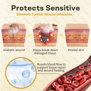🎊Special limited-time discount-Healrize® Bee Venom Intensive Diabetic Foot Treatment Spray🔥Best Seller🔥