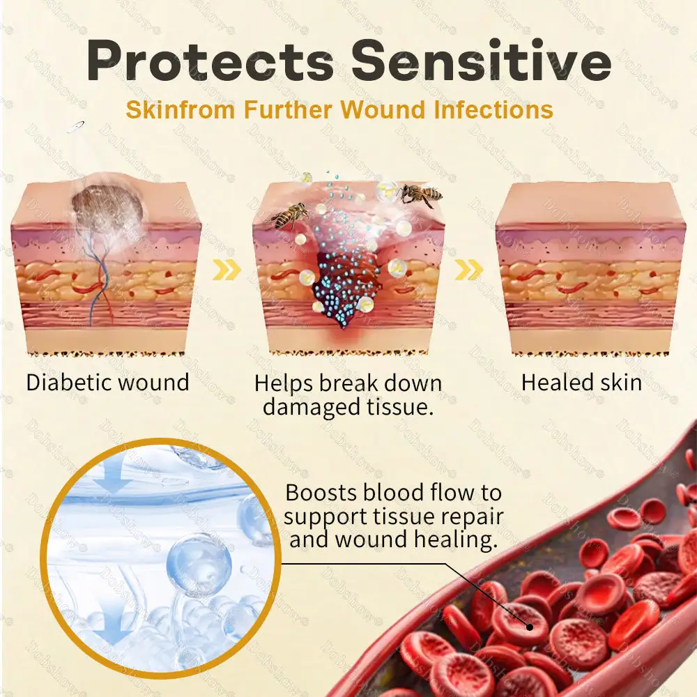 🎊Special limited-time discount-Healrize® Bee Venom Intensive Diabetic Foot Treatment Spray🔥Best Seller🔥