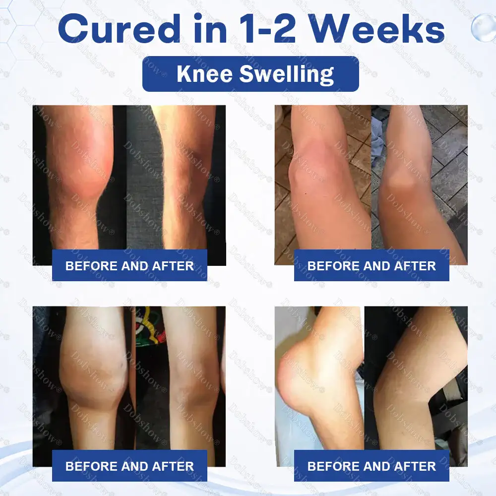 🏆𝐎𝐟𝐟𝐢𝐜𝐢𝐚𝐥 𝐔𝐒 𝐒𝐭𝐨𝐫𝐞-🎉Limited Time Offer⏳Healrize® Knee Joint Pain Relief Patches-Soothes Inflammation, Reduces Pain, Boosts Recovery-🔥Bestseller - 🌍 Global Shipping