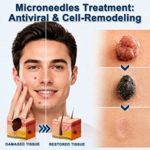 ✅🇺🇸𝐇𝐞𝒂𝒍𝗿𝗶𝙯𝙚®2-in-1 Microneedle & Hydrocolloid Patch🎀🎀| Removes Raised 
 – oxygenfe.com