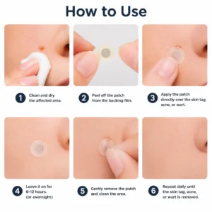 ✅🇺🇸𝐇𝐞𝒂𝒍𝗿𝗶𝙯𝙚®2-in-1 Microneedle & Hydrocolloid Patch🎀🎀| Removes Raised 
 – oxygenfe.com