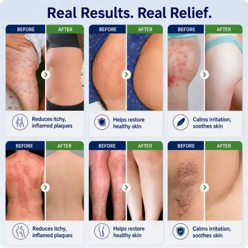 Healrize® 2-in-1 Liposomal Mag-Ceramide Spray