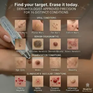 Healrize® 7-Day Skin Tag & Spot Eraser Painless & Scar-Free Advanced Imperfection Removal Rollerball Pen